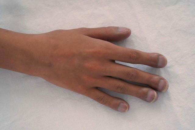 8 “dấu hiệu” bệnh tật nguy hiểm mà chúng ta thường bỏ qua - Ảnh 4.