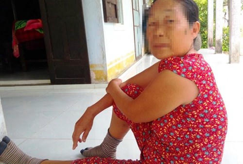 Nam thanh niên nhập viện cấp cứu sau xô xát với công an xã ảnh 2