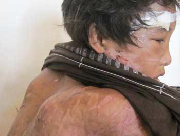 Cháu Hào Anh bị hành hạ dã man