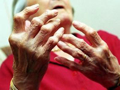 Run rẩy lúc xế chiều. Ảnh minh họa