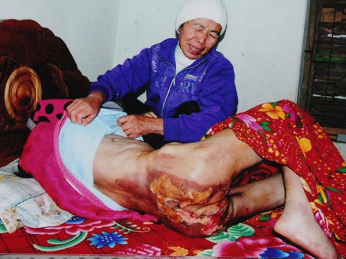 Người thân trào nước mắt căm phẫn khi chăm sóc bà Phương. 