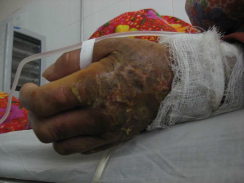 Nhiều người không phải rơi nước mắt khi nhìn bàn tay này...