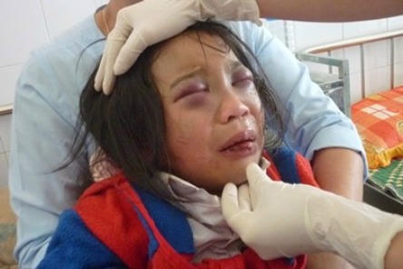 bé Phi chưa qua cơn hoảng loạn sau trận đòn của cha nuôi