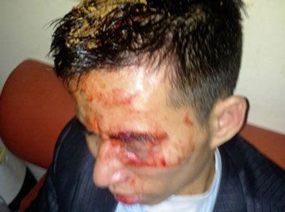 Anh mạnh bị nhóm côn đồ đánh dã man