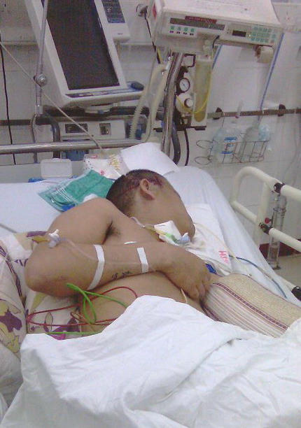 Nạn nhân hôn mê trong bệnh viện