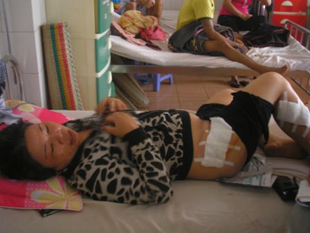 Vùng mông bị rạch nham nhở đã được bác sĩ may và băng lại.