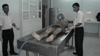 Một ca khám nghiệm tử thi.   Ảnh minh họa