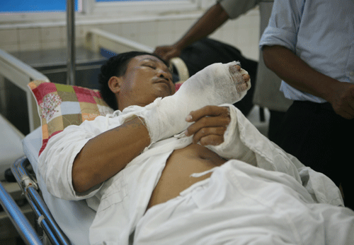 Anh Tuấn sau khi được phẫu thuật nối gân tay 