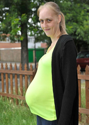 Sản phụ Kelly cho biết chiếc kim đâm ra từ bụng cô có thể là vật dụng phẫu thuật bác sĩ đã bỏ quên sau khi mổ ruột thừa cho cô. Ảnh: Metro.