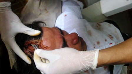 Anh Trần Duy Tuyên đang được các bác sỹ khâu vết thương.