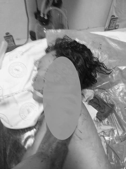 Một nạn nhân bị kẻ thủ ác hãm hại.