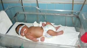 Một cháu bé may mắn được cứu thoát sau khi bị mẹ bóp mũi cho ngạt thở