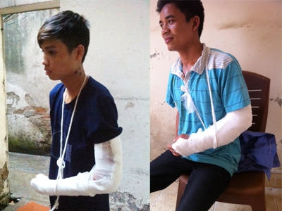 Ảnh công nhân bị hành hung