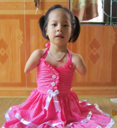 Nguyễn Linh Chi sinh ra đã không may mắn như những đứa trẻ khác.