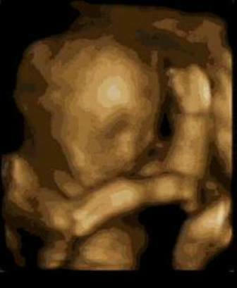 Hình chỉ mang tính minh họa (Internet)