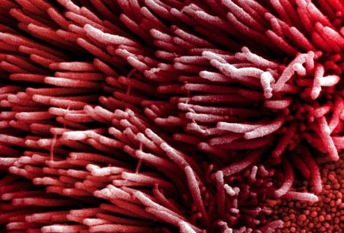 Có những triệu chứng này nghĩ ngay ung thư phổi