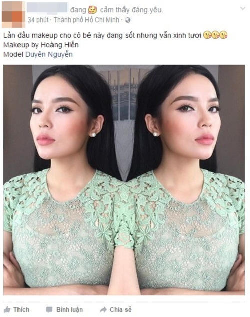 Kỳ Duyên nói về nguyên nhân khuôn mặt bị 'biến dạng'