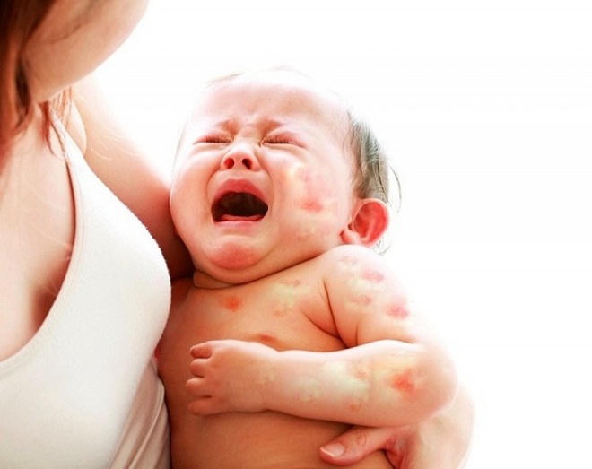 Tuyệt chiêu giúp mẹ phòng bệnh cho bé khi thời tiết giao mùa