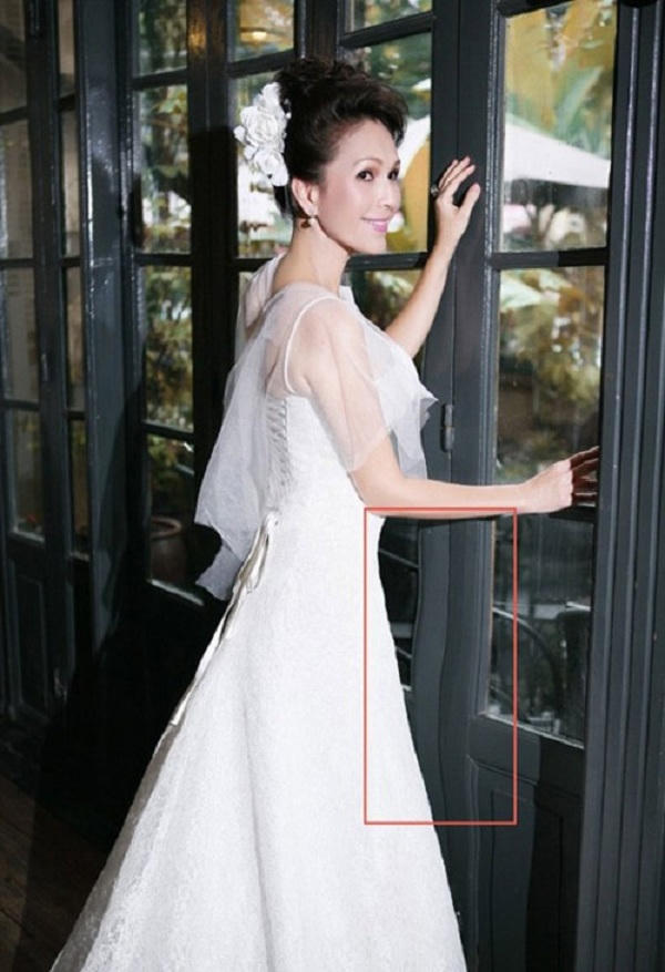 'Thủ phạm' khiến hàng loạt người đẹp Việt biến dạng