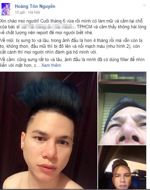 Gương mặt biến dạng sau phẫu thuật, Hoàng Tôn “cầu cứu” cộng đồng