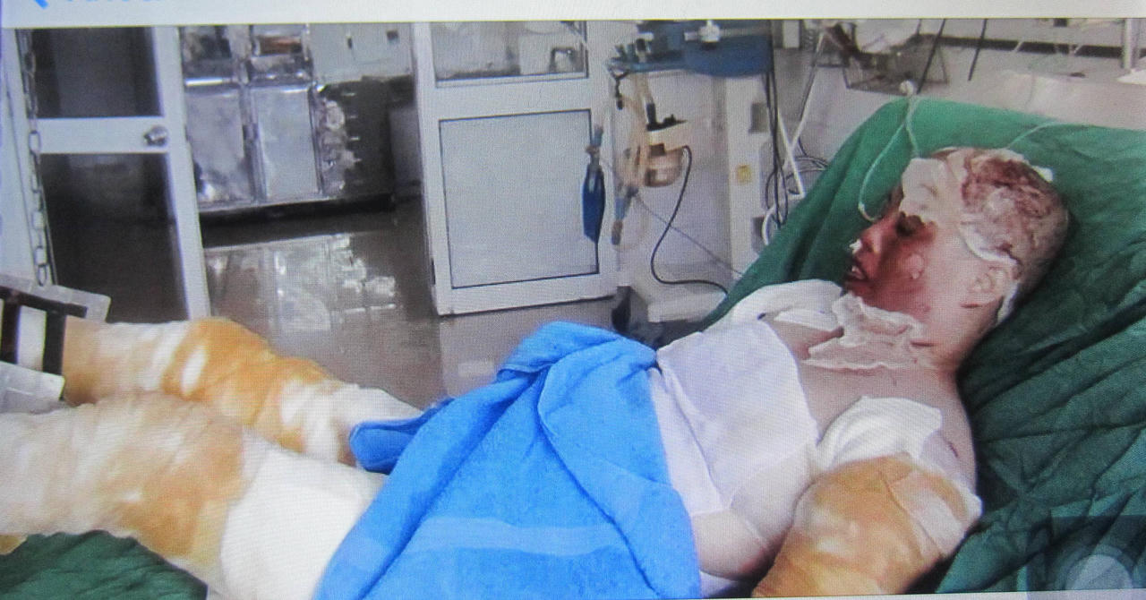 Gặp lại góa phụ thoát chết trong vụ cháy nhà khó hiểu