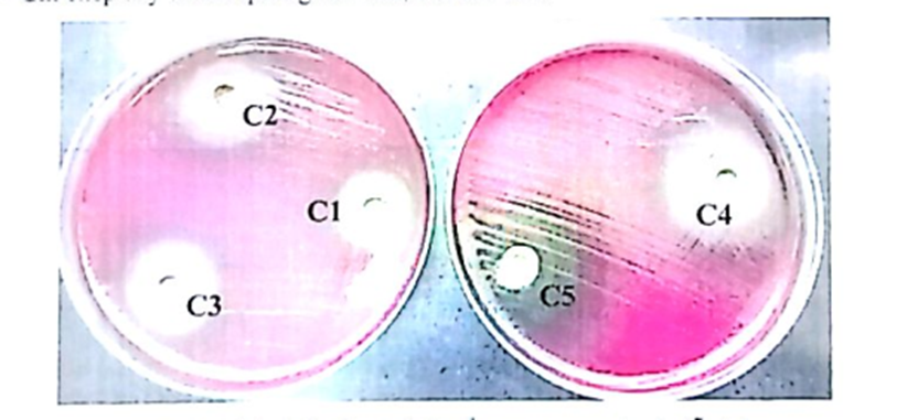 Đánh giá hiệu quả ức chế vi khuẩn HP của thực phẩm bảo vệ sức khỏe Bình Vị Thái Minh