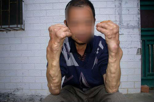 C2, Rồng đỏ nhiễm chì: Hội bảo vệ người tiêu dùng xem xét khởi kiện nhà sản xuất