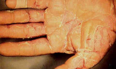 C2, Rồng đỏ nhiễm chì: Hội bảo vệ người tiêu dùng xem xét khởi kiện nhà sản xuất