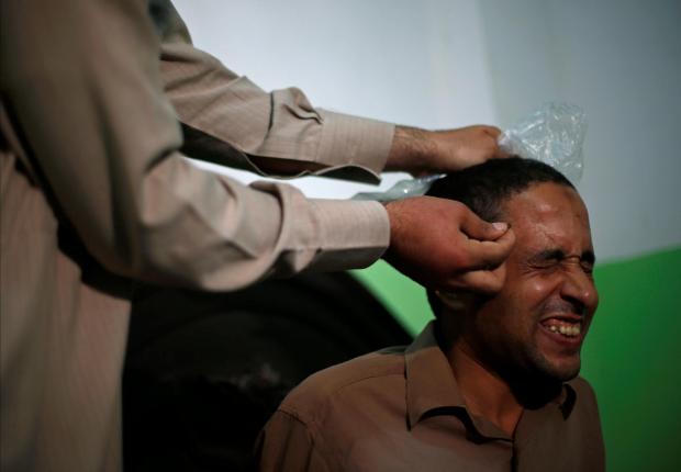 Kỳ lạ người đàn ông Ai Cập dùng nọc độc ong trị bệnh