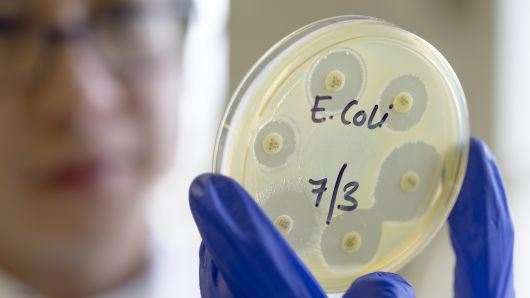 Bí ẩn dịch bệnh khiến 72 người ở Mỹ nhiễm bệnh