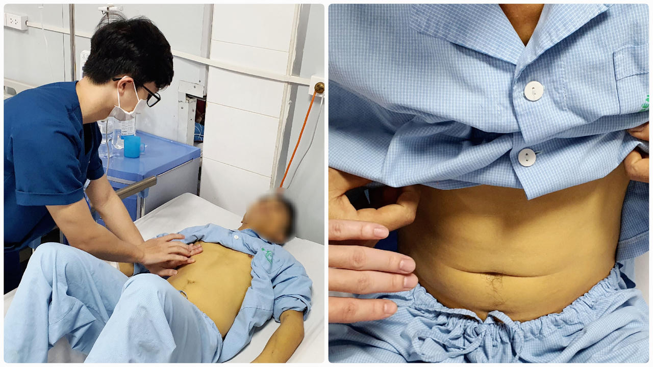 Nhận diện loài nấm khiến 2 người ăn phải cấp cứu tại Bệnh viện Bạch Mai