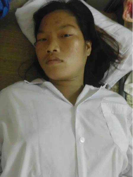 Thai nhi 36 tuần tuổi chết oan vì mẹ bị xe máy đâm