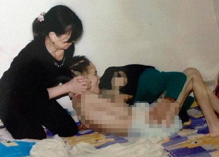 Nữ sinh bị người yêu đánh chấn thương sọ não vì ghen