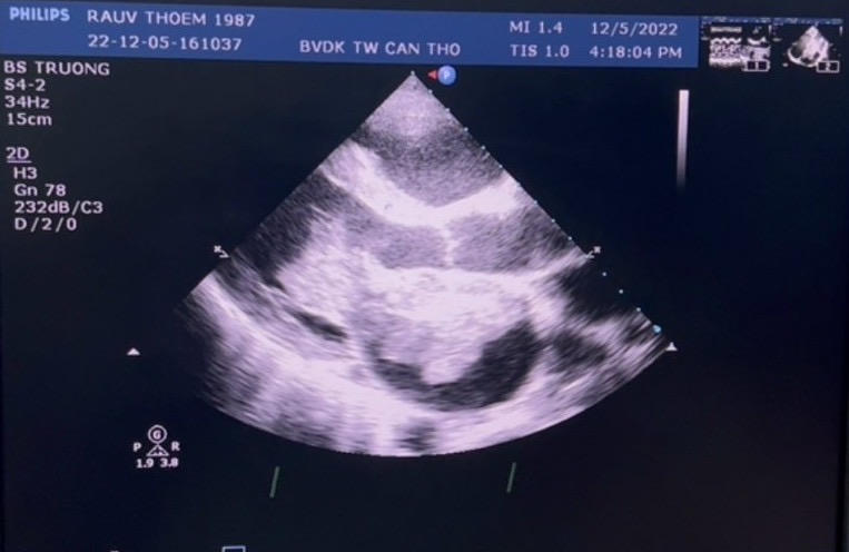 Cứu sống nam thanh niên Campuchia nguy kịch