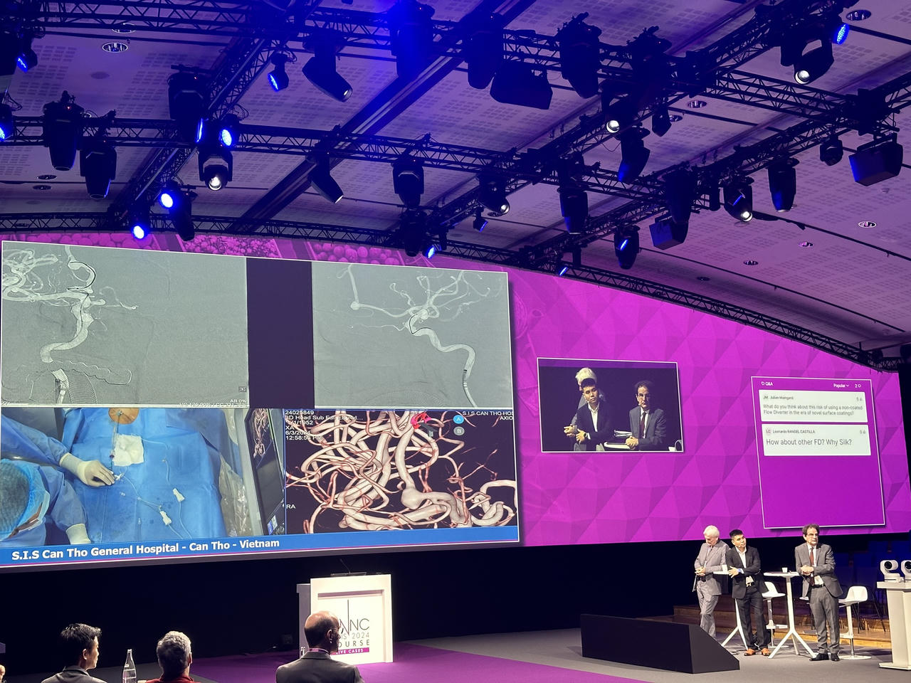 Bác sĩ bệnh viện S.I.S Cần Thơ thị phạm chữa đột quỵ cho hơn 500 bác sĩ trên thế giới theo dõi 