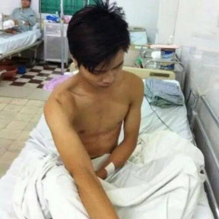 Hà Nội: Sinh viên bị nhóm côn đồ chém rách lưng vì va chạm xe máy