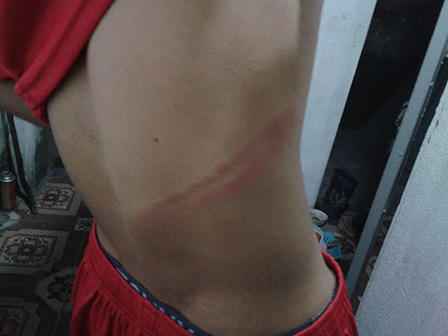 Hưng Yên: “An ninh thôn” dùng dùi cui đánh dân, bắt nộp phạt tại chỗ