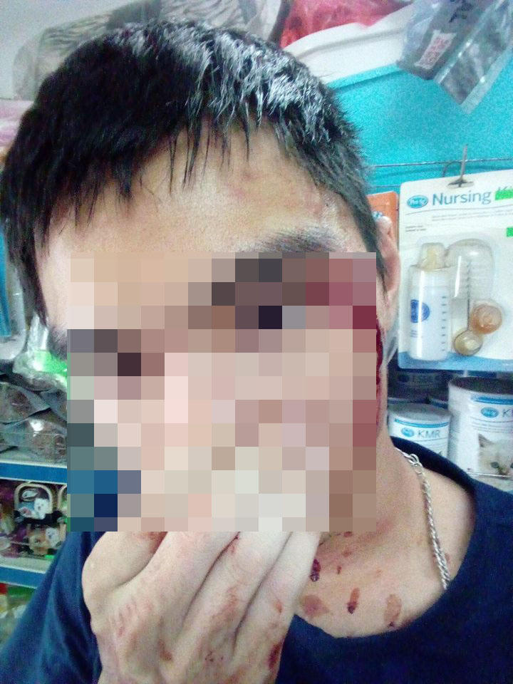 Lái xe GrabBike đánh người vì không nhường đường?