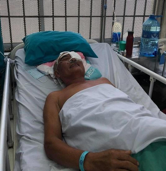 Người đàn ông bị thanh gỗ 30cm xuyên qua đầu