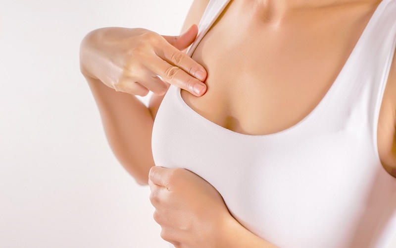 Chủ quan khối u vú, người phụ nữ ngỡ ngàng phát hiện ung thư vú thể lan tỏa hiếm gặp 