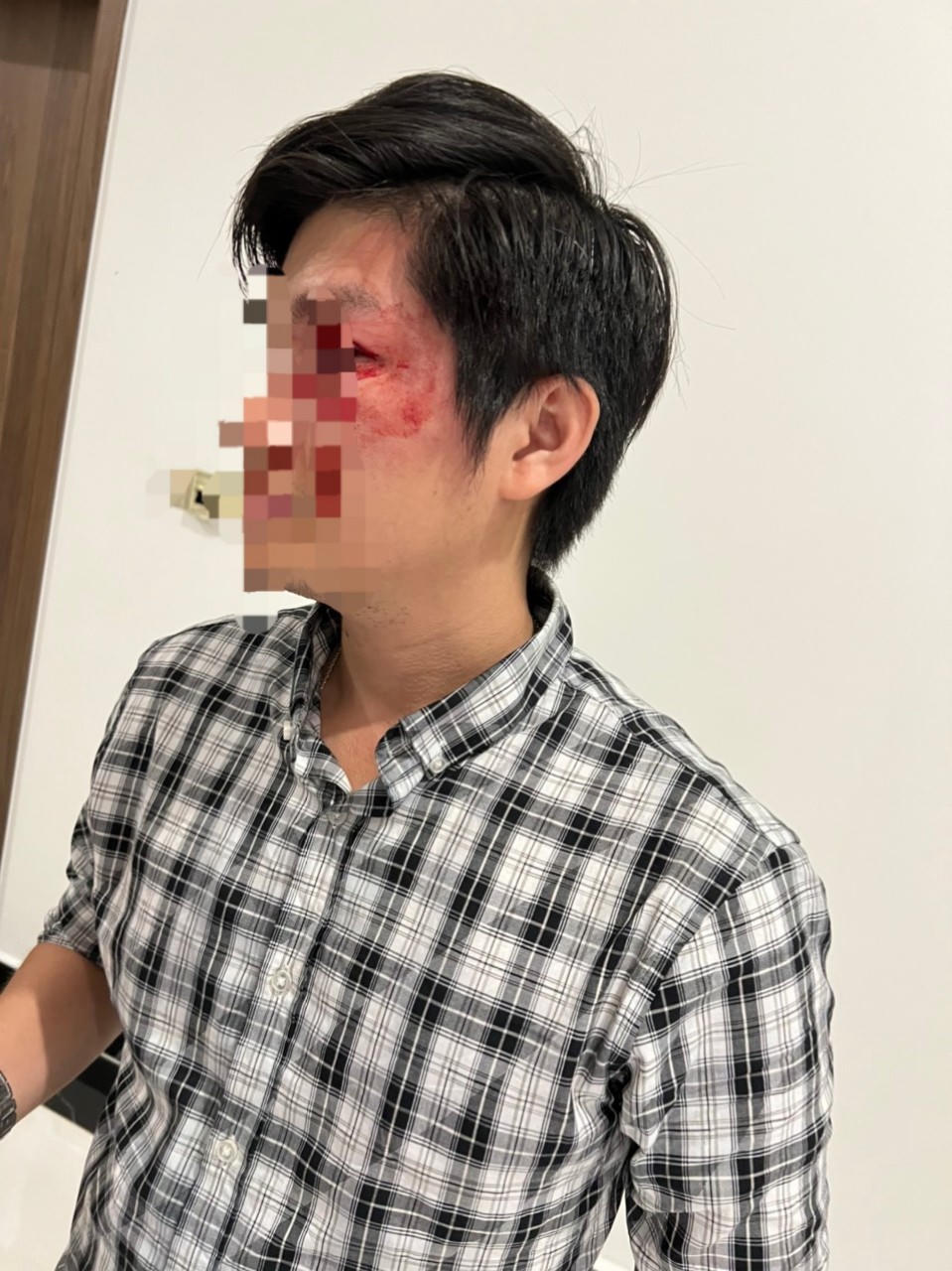 Bảo vệ con khỏi chó thả rông "tấn công", người bố bị hành hung dã man