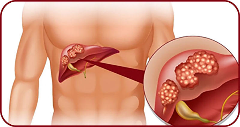 Nước uống tái tạo năng lượng, tăng cường miễn dịch, bảo vệ gan Golden Lypres® Refreshing cho sức khỏe vàng