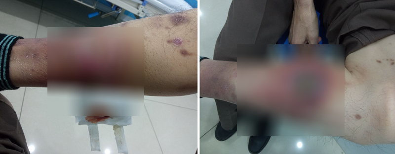 Sống chung với bệnh mạn tính không còn là ác mộng chỉ bằng cái 'chạm tay'