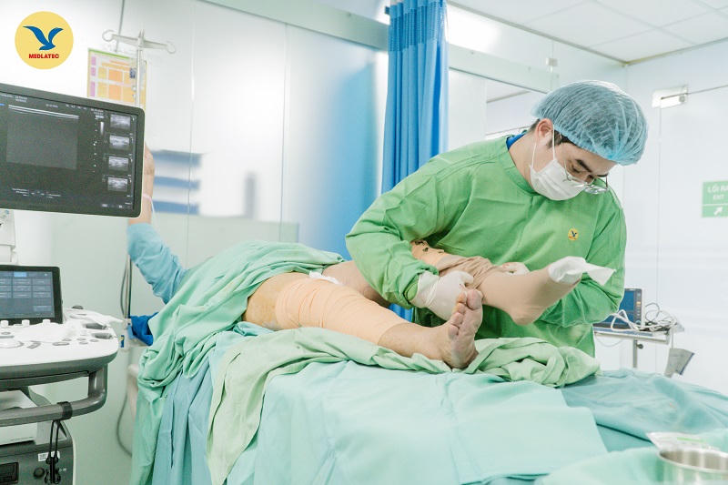 Bệnh viện Đa khoa MEDLATEC - Điều trị suy giãn tĩnh mạch phức tạp bằng đốt laser