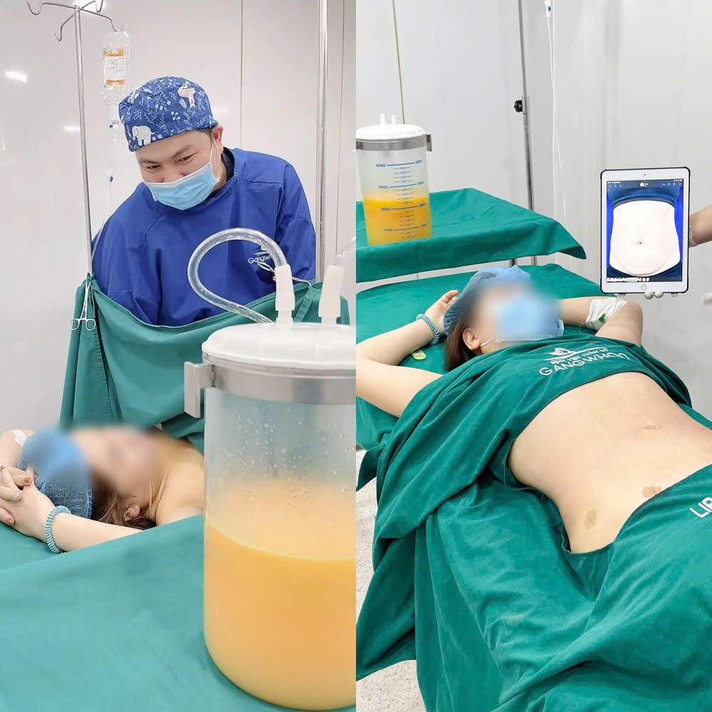 Điều Bình Thường Thẩm Mỹ Công Nghệ Cao Tại Bệnh Viện Thẩm Mỹ Gangwhoo