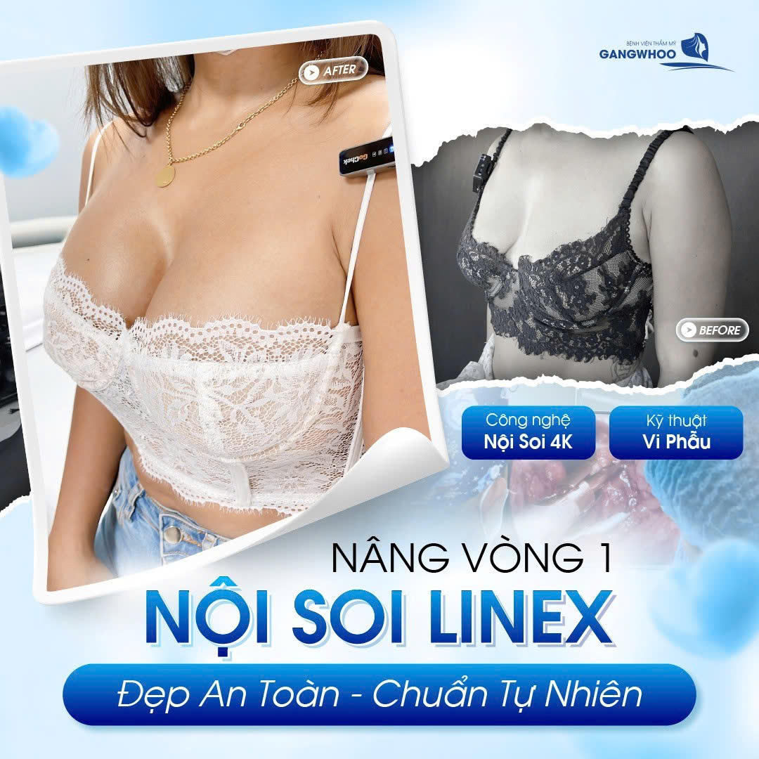 Điều Bình Thường Thẩm Mỹ Công Nghệ Cao Tại Bệnh Viện Thẩm Mỹ Gangwhoo