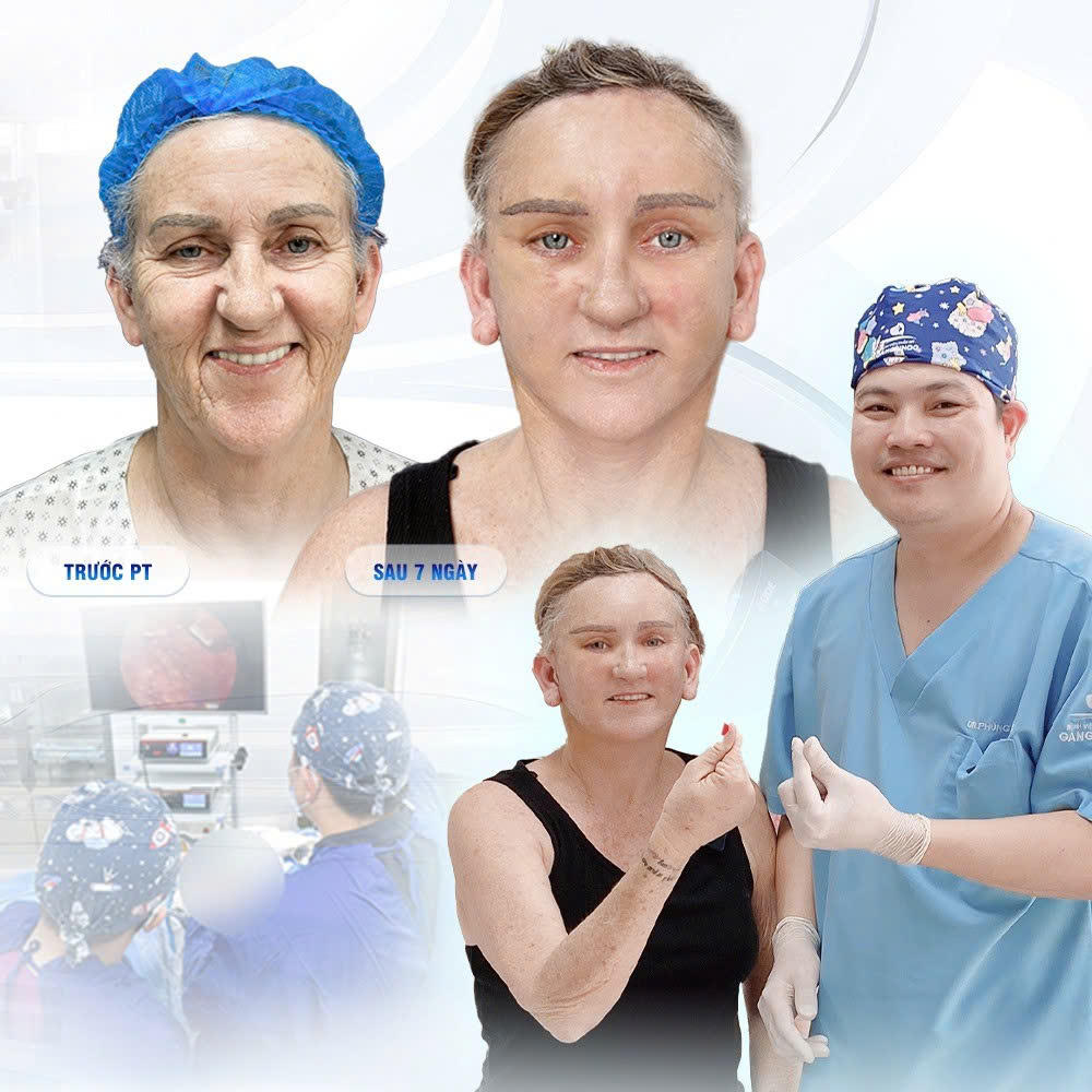 Điều Bình Thường Thẩm Mỹ Công Nghệ Cao Tại Bệnh Viện Thẩm Mỹ Gangwhoo