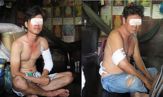 Gia đình 4 người ở Sài Gòn bị truy sát: Thoát chết, nạn nhân nêu tên thủ phạm