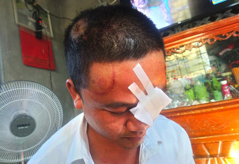 Đạp bà hàng xóm xuống ruộng, chém 2 người nhập viện chỉ vì… tấm lưới rào gà