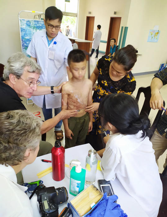 Bệnh viện Trung ương Huế khám và phẫu thuật cho hơn 200 bệnh nhân dị tật bẩm sinh